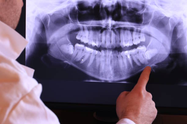 Best Emergency Dental Care for Sports Injuries in Belle, WV