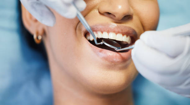 Best Emergency Root Canal Therapy in Belle, WV