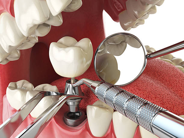 Best 24-Hour Emergency Dental Care in Belle, WV